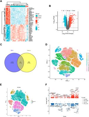 Single-cell transcriptomics reveals immune infiltrate in sepsis